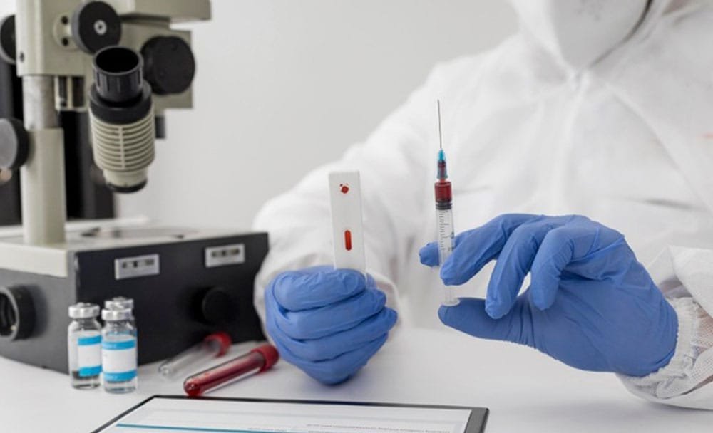Home Remedies to Reduce ESR Levels