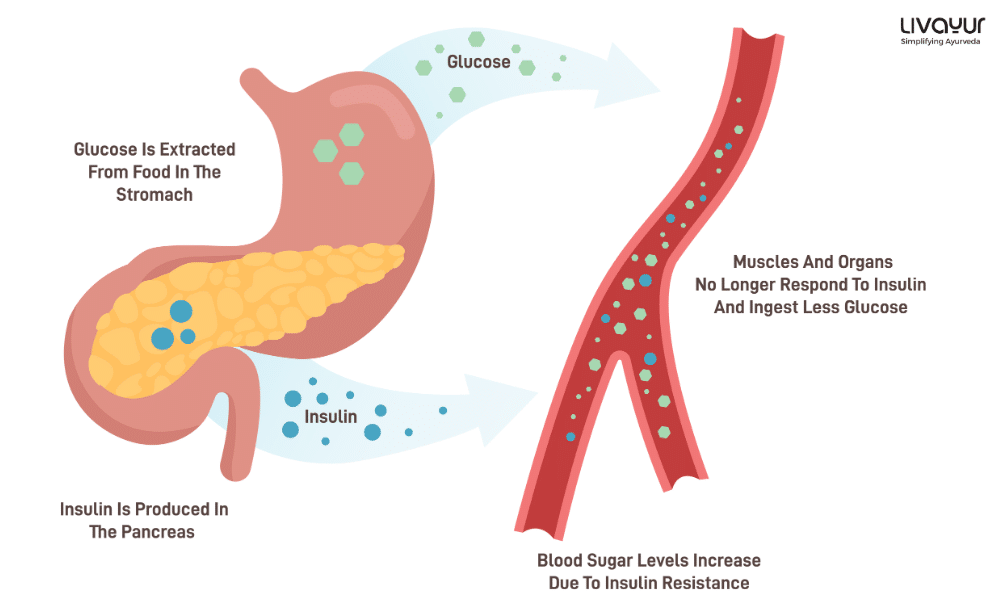 Type 2 Diabetes (1) Type 2 Diabetes What is it Symptoms Causes Risk Factors Treatment