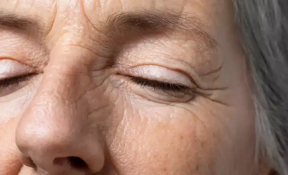wrinkle causes