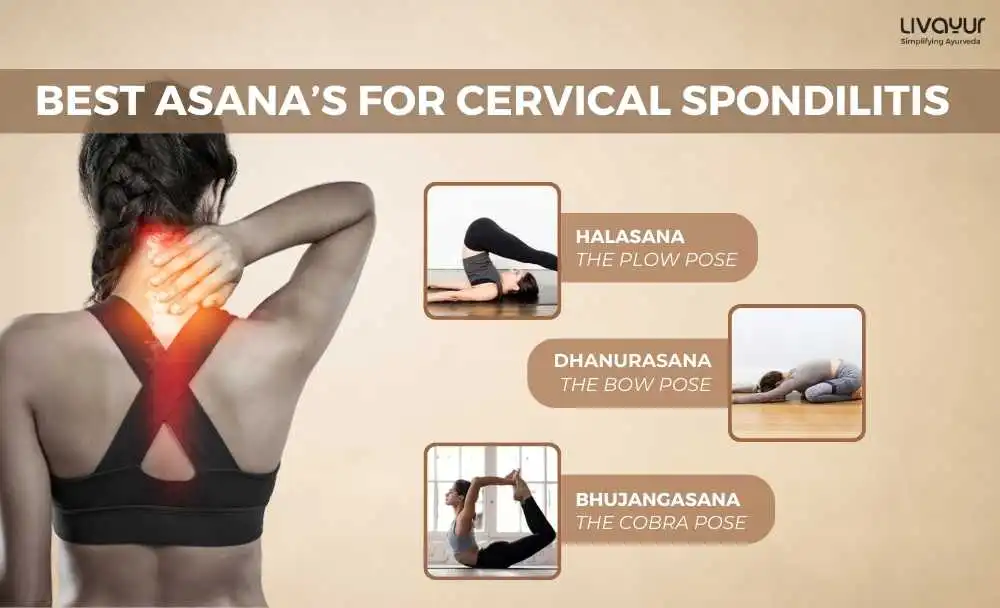 10 Best Exercises to Relieve cervical spondylosis 10 Best Exercises to Relieve cervical spondylosis